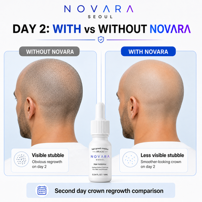 NOVARA™ Precision Hair Inhibitor Serum — Targeted Drops